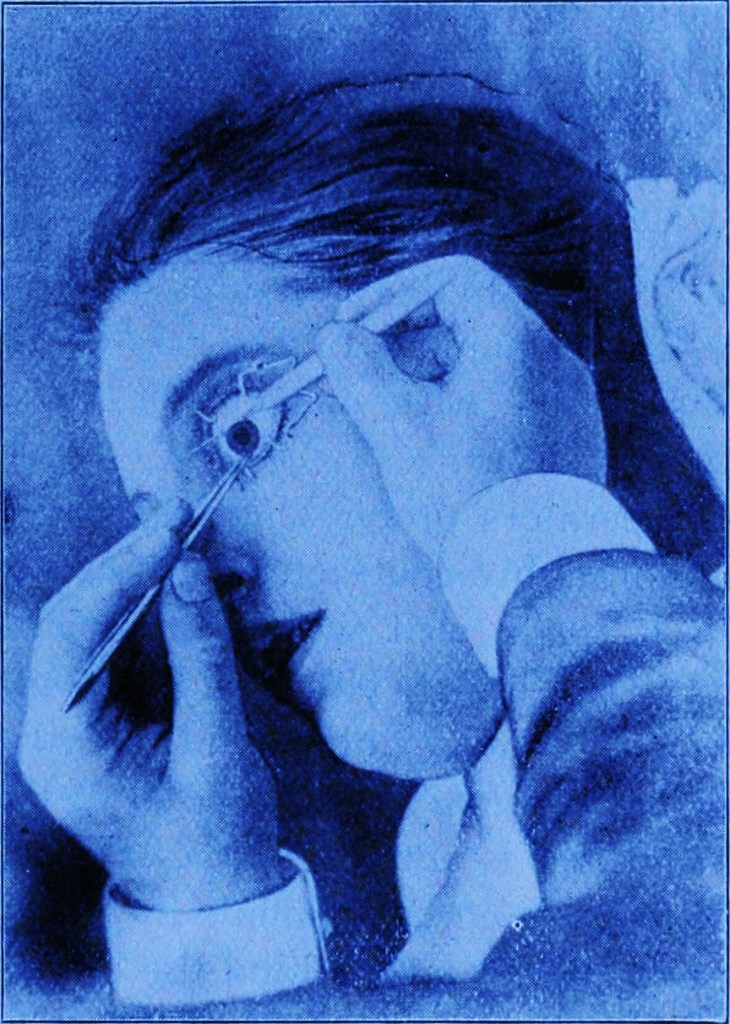 The Tepid Hemorrhage